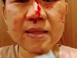 VIRAL! Perempuan Asal Cianjur Menangis Bersimbah Darah di Libya, Ngaku Tak Digaji Tiga Bulan dan Minta Tolong Presiden
